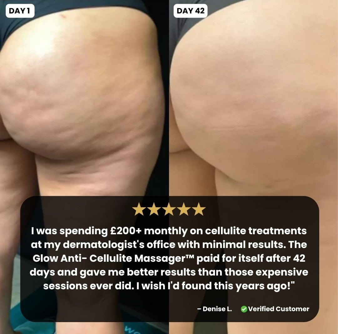 The Glow Anti-Cellulite Massager™