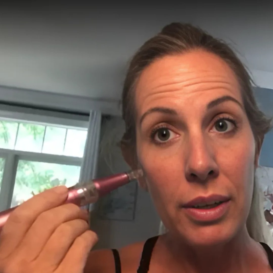 The Glow Pen™ | Microneedling Derma Pen