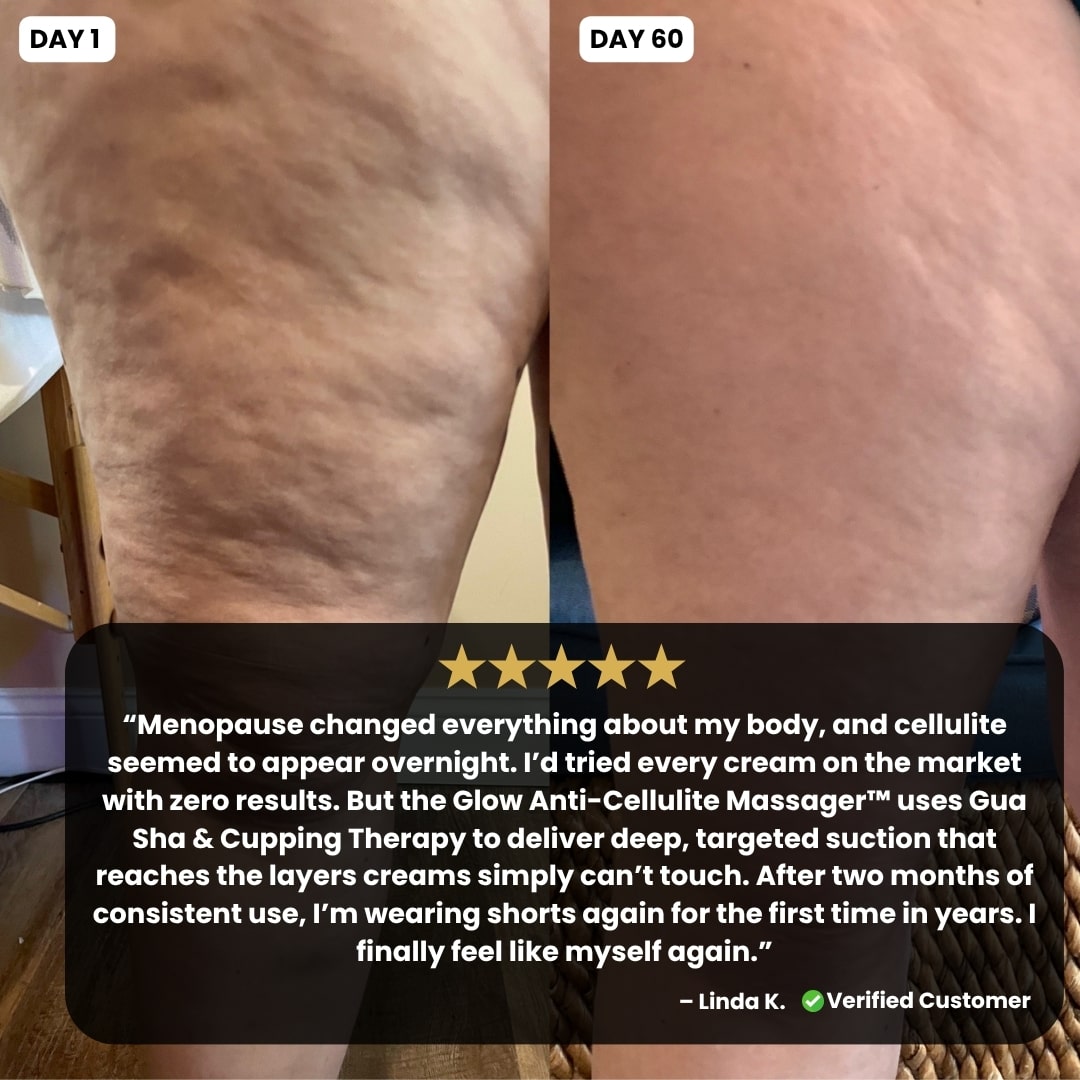 The Glow Anti-Cellulite Massager™