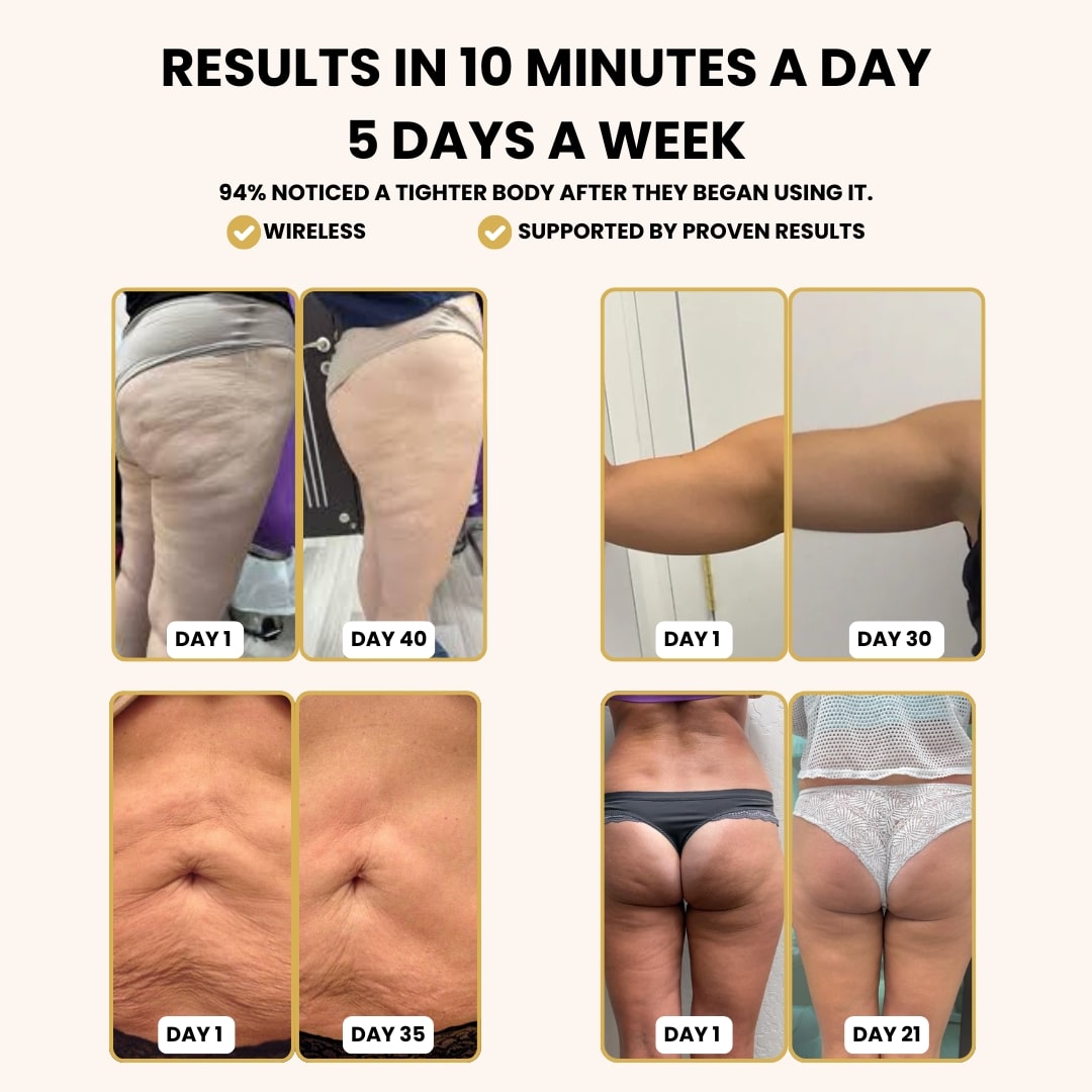 The Glow Anti-Cellulite Massager™