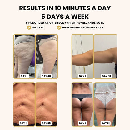 The Glow Anti-Cellulite Massager™