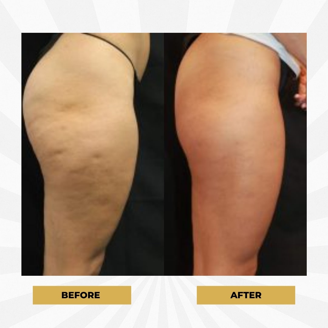 The Glow Magic™ Body Lifting Oil